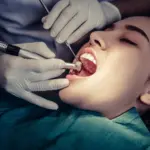 Quantos Anos Dura um Canal no Dente