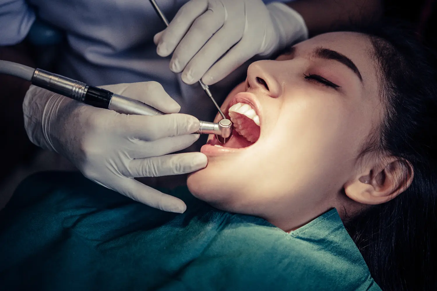 Quantos Anos Dura um Canal no Dente